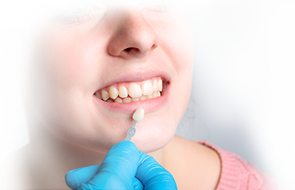 Лечение передних зубов 2