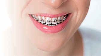 Недорогое отбеливание зубов 3