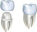 материал для зубных протезов