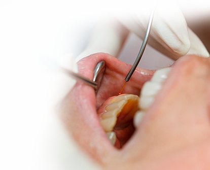 Преимущества лазерной стоматологии