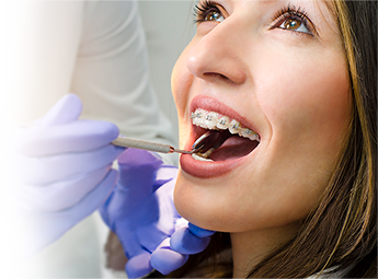 Основные стадии ортодонтического лечения брекетами