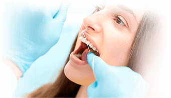 Недорогое отбеливание зубов 4