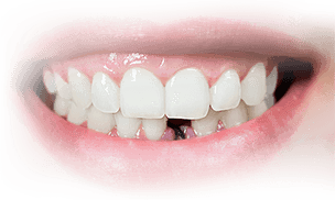 Недорогое протезирование зубов 2