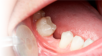 Консультация стоматолога-ортопеда